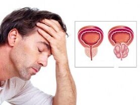 Prostatitis in a person